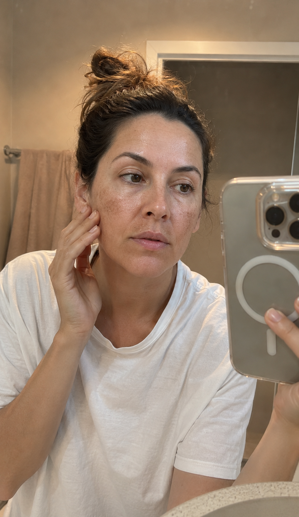 You're Not Dirty. It's Called Melasma.
