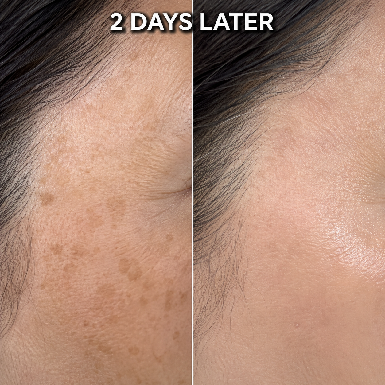 Dark Spot and Melasma Fade Cream - Arbutin 7% + Tranexamic Acid 4%