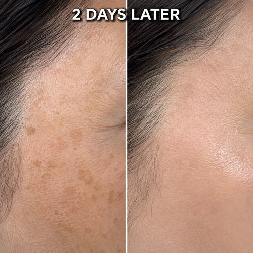 Dark Spot and Melasma Fade Cream - Arbutin 7% + Tranexamic Acid 4%