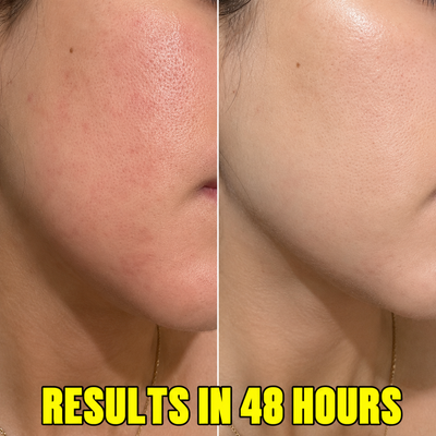 Dark Spot and Melasma Fade Cream - Arbutin 7% + Tranexamic Acid 4%